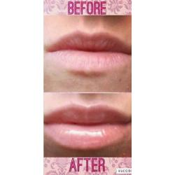 Contouring lipgloss