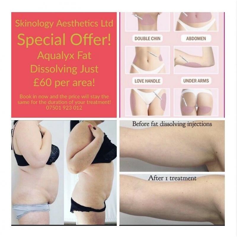 Aqualyx Fat Dissolving Injections